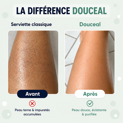 Douceal